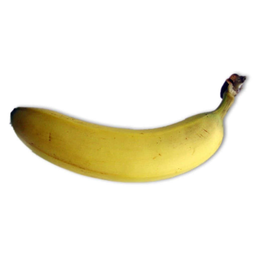 Banana Sign in Fetal Ultrasound (Chuối (ảnh))