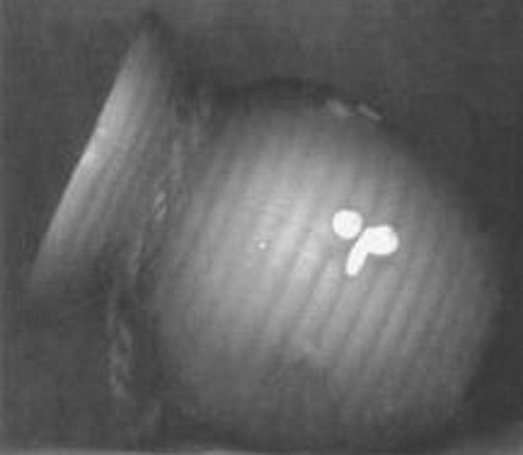 Tako-tsubo pot (photo)