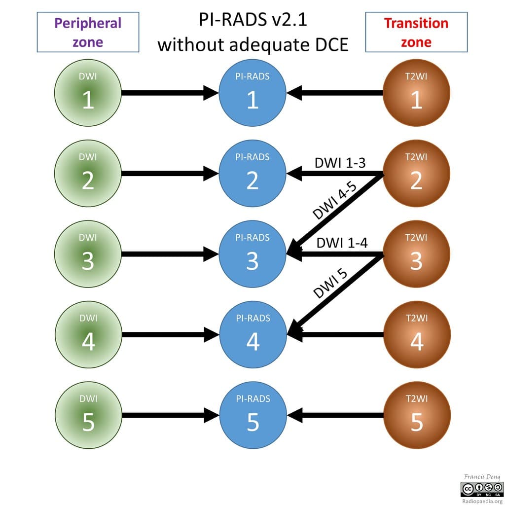 PI-RADS v2.1 flowchart